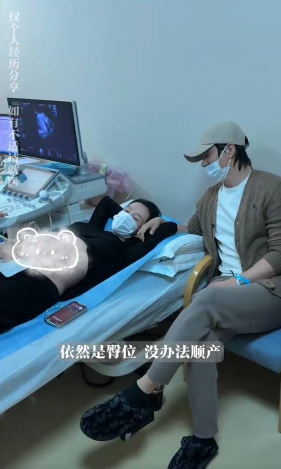 张檬坦言：35周胎儿臀位且绕颈，不得不选择剖腹产-1