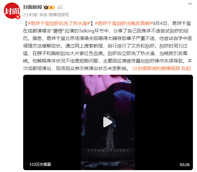 易烊千玺透露:刮痧后洗澡致高烧-2 易烊千玺透露:刮痧后洗澡致高烧-2